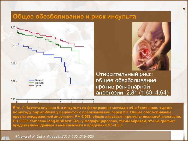 Общее обезболивание и риск инсульта Относительный риск: общее обезболивание против регионарной анестезии: 2, 81