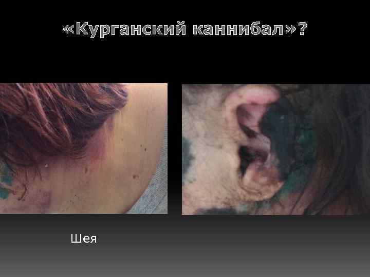  «Курганский каннибал» ? Шея 