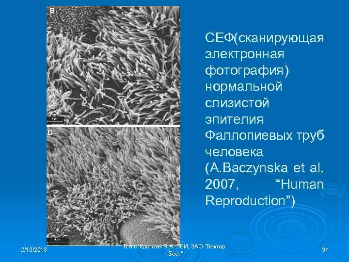 СЕФ(сканирующая электронная фотография) нормальной слизистой эпителия Фаллопиевых труб человека (A. Baczynska et al. 2007,