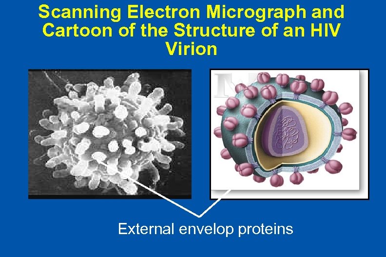 Scanning Electron Micrograph and Cartoon of the Structure of an HIV Virion External envelop