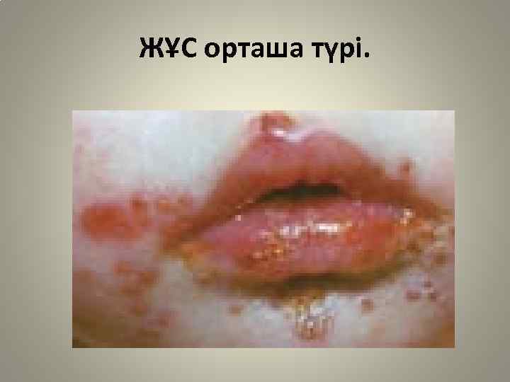 ЖҰС орташа түрі. 