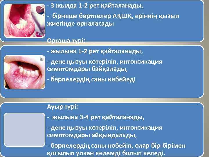 - 3 жылда 1 -2 рет қайталанады, - бірнеше бөртпелер АҚШҚ, еріннің қызыл жиегінде