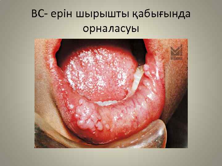 ВС- ерін шырышты қабығында орналасуы 