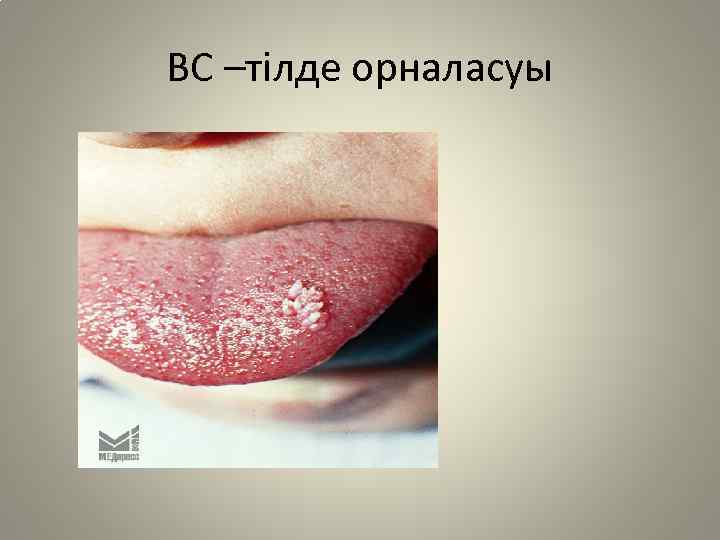 ВС –тілде орналасуы 
