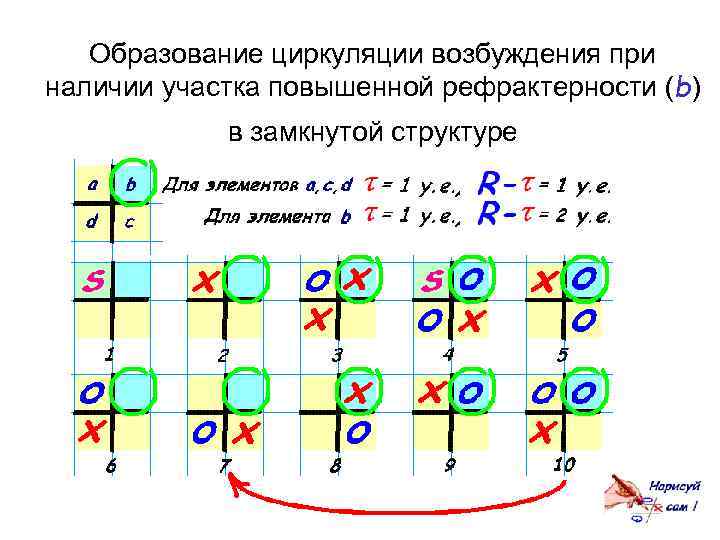 Образование циркуляции возбуждения при наличии участка повышенной рефрактерности (b) в замкнутой структуре 