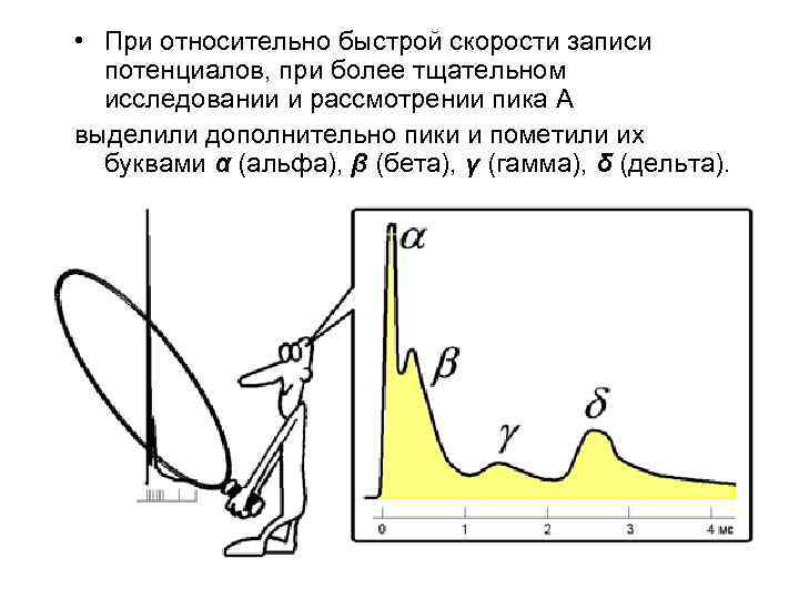  • При относительно быстрой скорости записи потенциалов, при более тщательном исследовании и рассмотрении