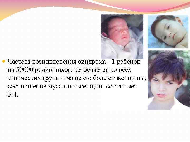  Частота возникновения синдрома - 1 ребенок на 50000 родившихся, встречается во всех этнических