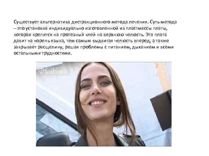 Существует альтернатива дистракционного метода лечения. Суть метода – это установка индивидуально изготовленной из пластмассы