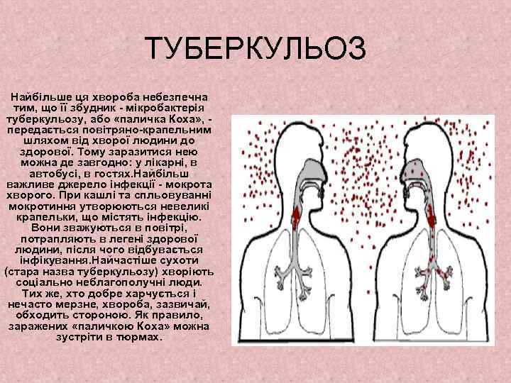 ТУБЕРКУЛЬОЗ Найбільше ця хвороба небезпечна тим, що її збудник - мікробактерія туберкульозу, або «паличка