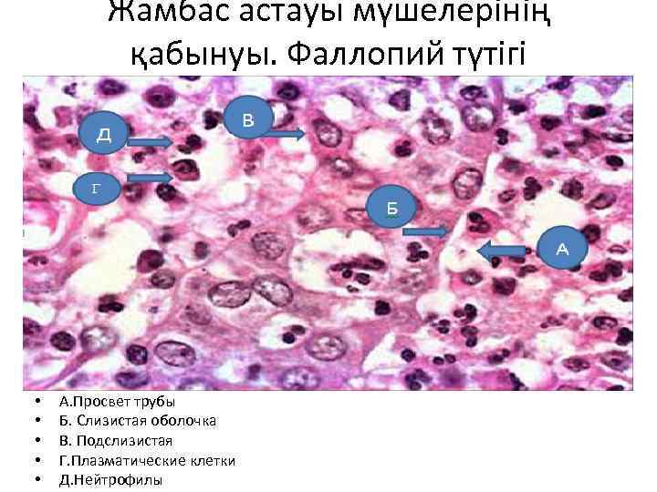 Жамбас астауы мүшелерінің қабынуы. Фаллопий түтігі • • • А. Просвет трубы Б. Слизистая
