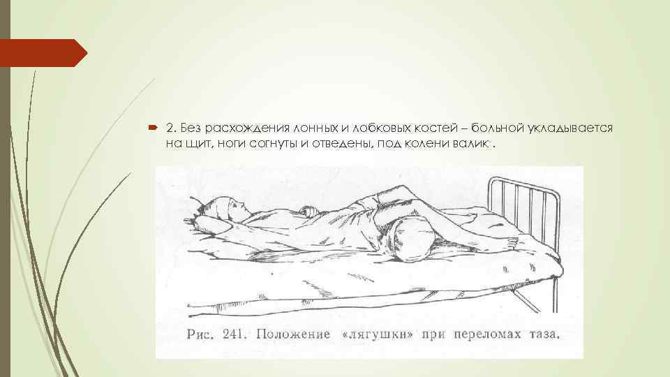  2. Без расхождения лонных и лобковых костей – больной укладывается на щит, ноги