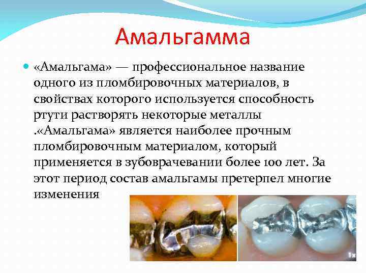 Амальгамма «Амальгама» — профессиональное название одного из пломбировочных материалов, в свойствах которого используется способность