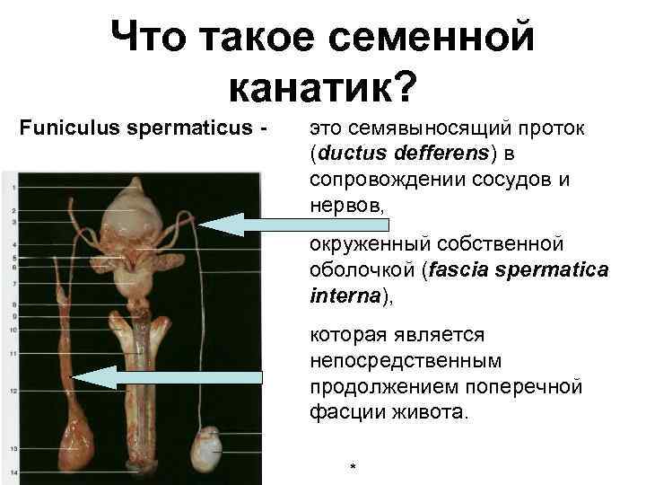 Где находится семенной канатик у мужчин фото