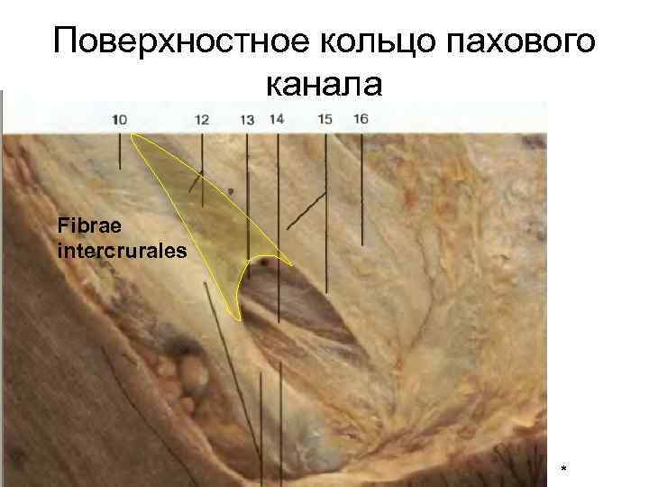 Поверхностное кольцо пахового канала Fibrae intercrurales * 