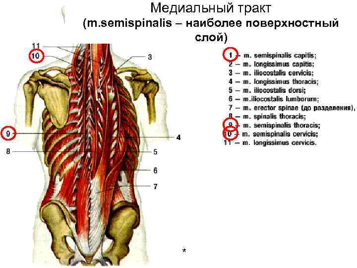 Медиальный тракт (m. semispinalis – наиболее поверхностный слой) * 