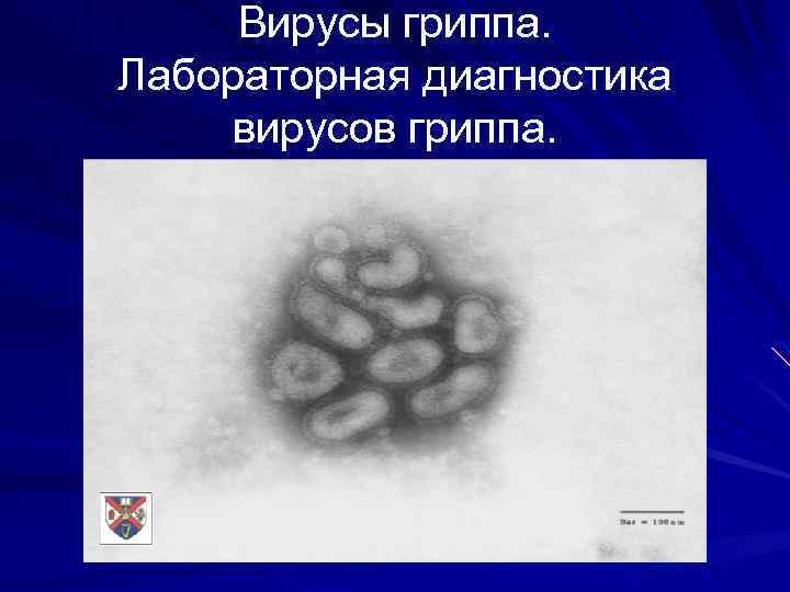 Вирусы гриппа. Лабораторная диагностика вирусов гриппа. 