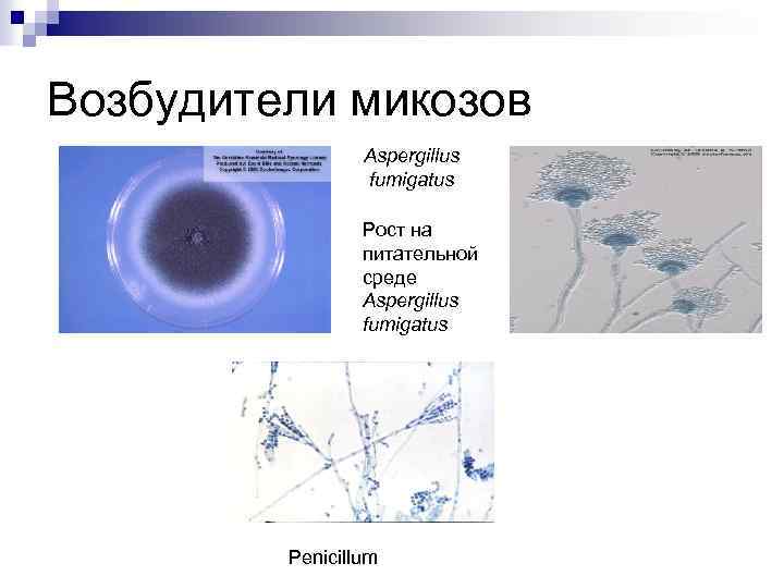 Возбудители микозов Aspergillus fumigatus Рост на питательной среде Aspergillus fumigatus Penicillum 