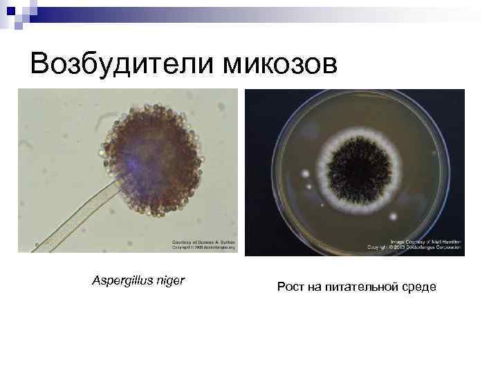 Возбудители микозов Aspergillus niger Рост на питательной среде 