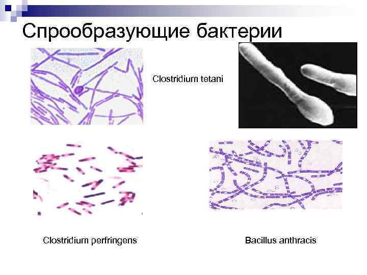 Спрообразующие бактерии Clostridium tetani Clostridium perfringens Bacillus anthracis 