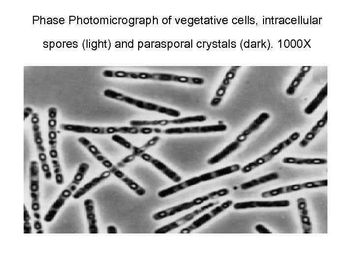 Phase Photomicrograph of vegetative cells, intracellular spores (light) and parasporal crystals (dark). 1000 X