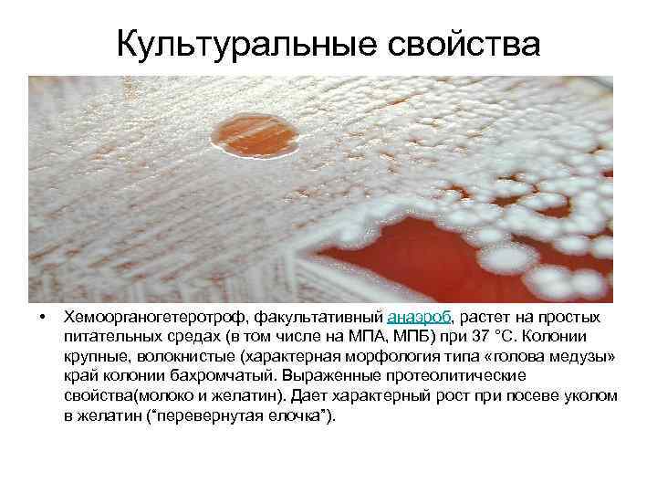 Культуральные свойства – • Хемоорганогетеротроф, факультативный анаэроб, растет на простых питательных средах (в том