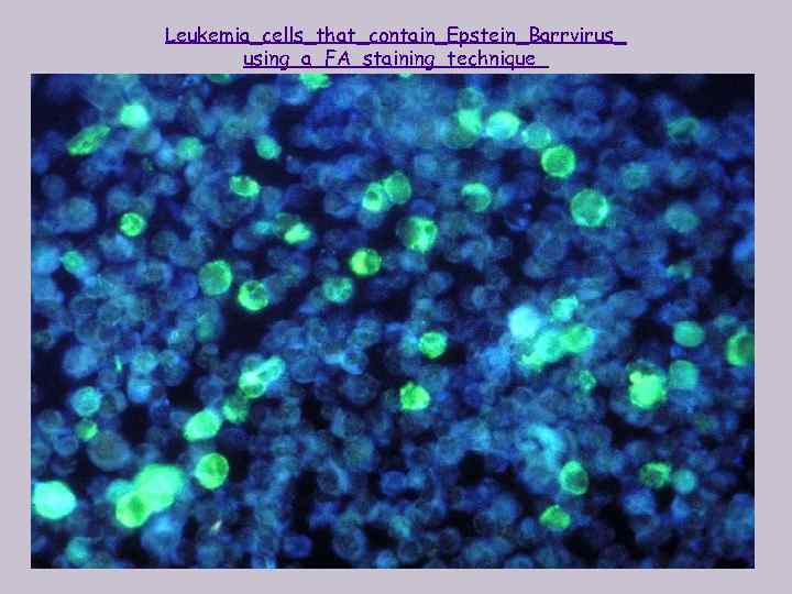 Leukemia_cells_that_contain_Epstein_Barrvirus_ using_a_FA_staining_technique_ 