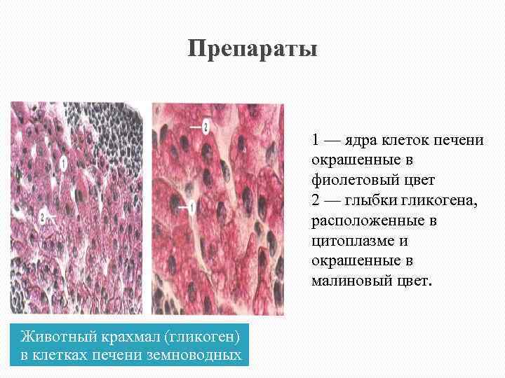 Препараты 1 — ядра клеток печени окрашенные в фиолетовый цвет 2 — глыбки гликогена,