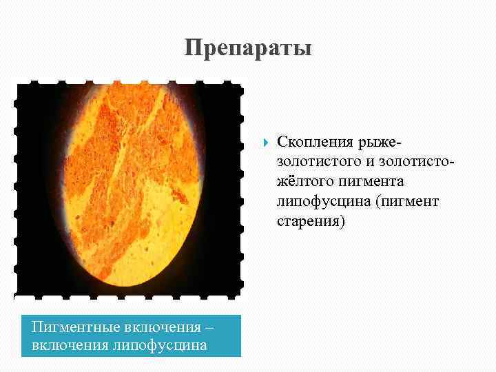 Препараты Пигментные включения – включения липофусцина Скопления рыже золотистого и золотисто жёлтого пигмента липофусцина