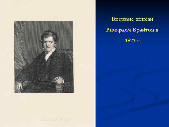 Впервые описан Ричардом Брайтом в 1827 г. 