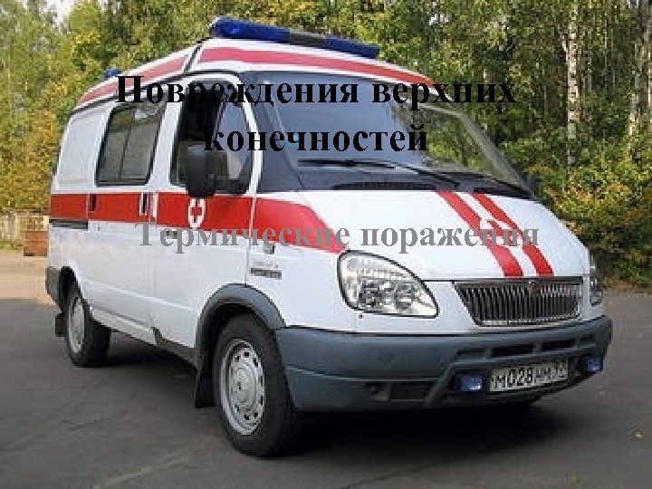 Повреждения верхних конечностей Термические поражения 