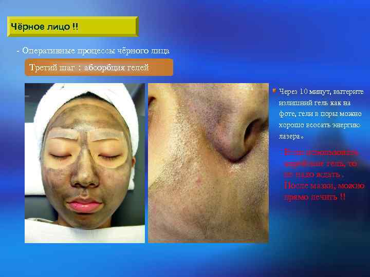 Чёрное лицо !! - Оперативные процессы чёрного лица Третий шаг：абсорбция гелей Через 10 минут,