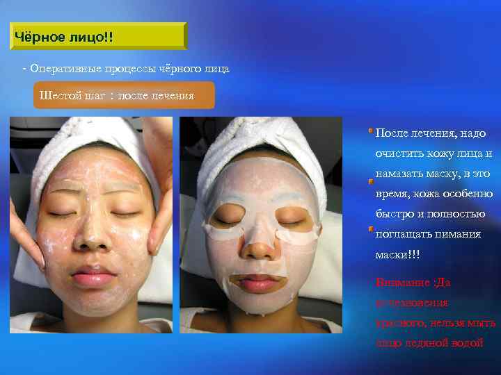 Чёрное лицо!! - Оперативные процессы чёрного лица Шестой шаг：после лечения После лечения, надо очистить