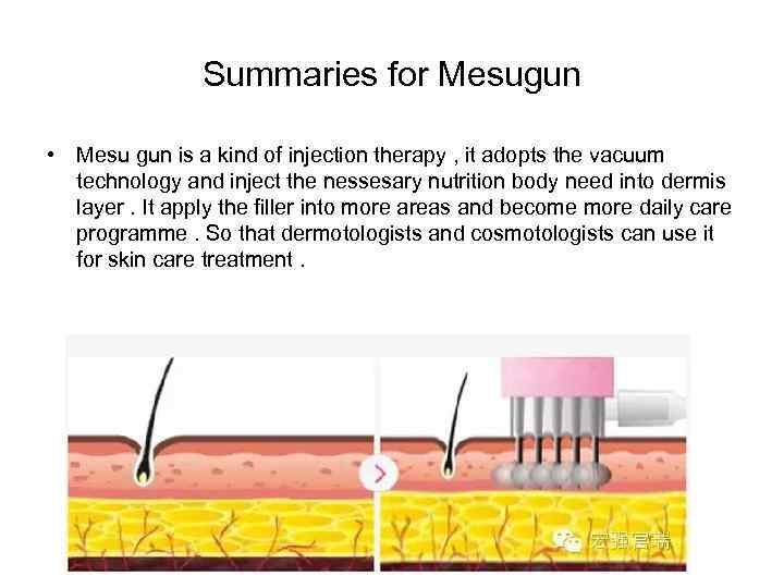 Summaries for Mesugun • Mesu gun is a kind of injection therapy , it
