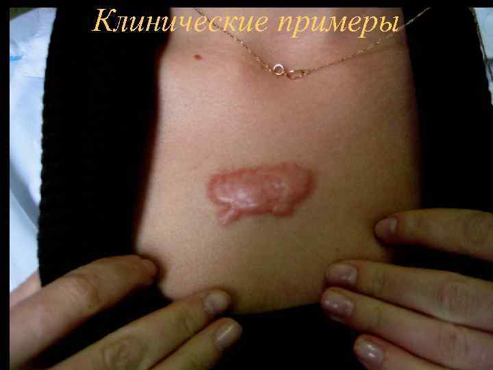 Клинические примеры 