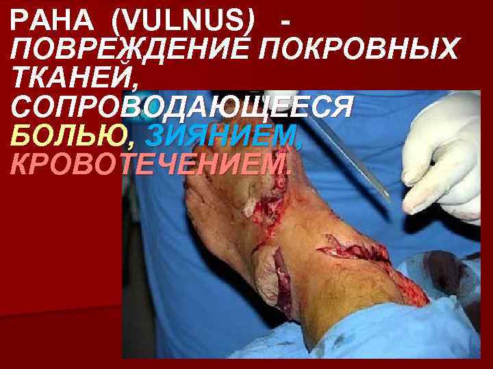 РАНА (VULNUS) ПОВРЕЖДЕНИЕ ПОКРОВНЫХ ТКАНЕЙ, СОПРОВОДАЮЩЕЕСЯ БОЛЬЮ, ЗИЯНИЕМ, КРОВОТЕЧЕНИЕМ. 