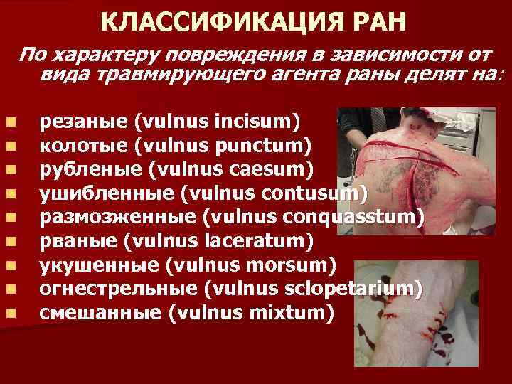 КЛАССИФИКАЦИЯ РАН По характеру повреждения в зависимости от вида травмирующего агента раны делят на: