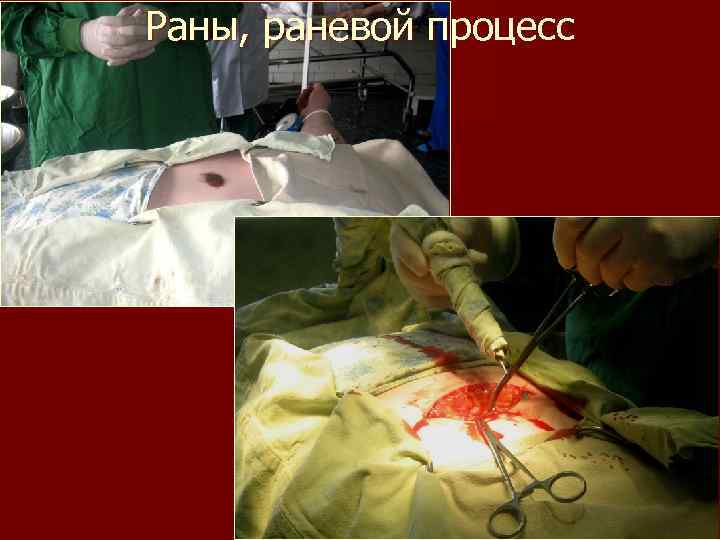 Раны, раневой процесс 