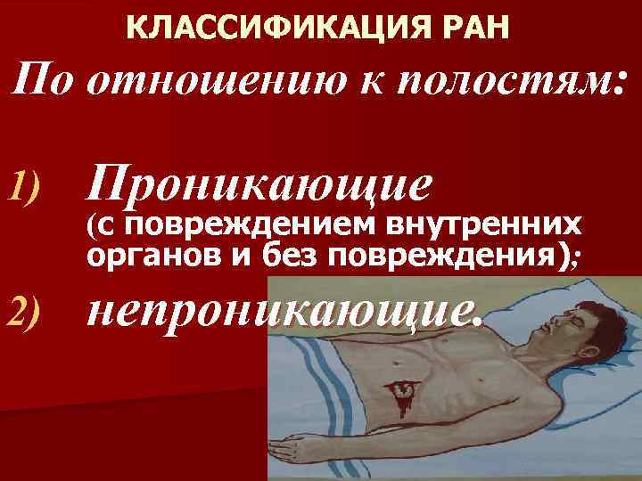КЛАССИФИКАЦИЯ РАН По отношению к полостям: 1) Проникающие 2) непроникающие. (с повреждением внутренних органов
