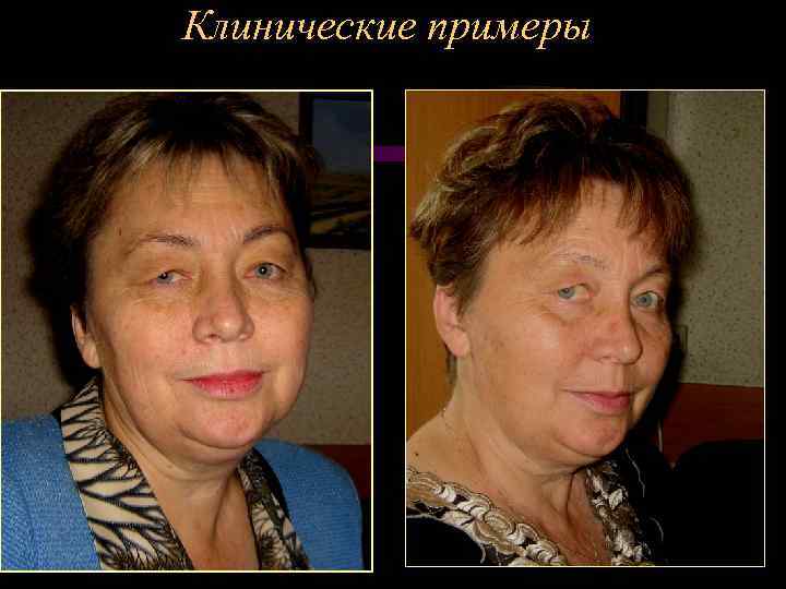 Клинические примеры 