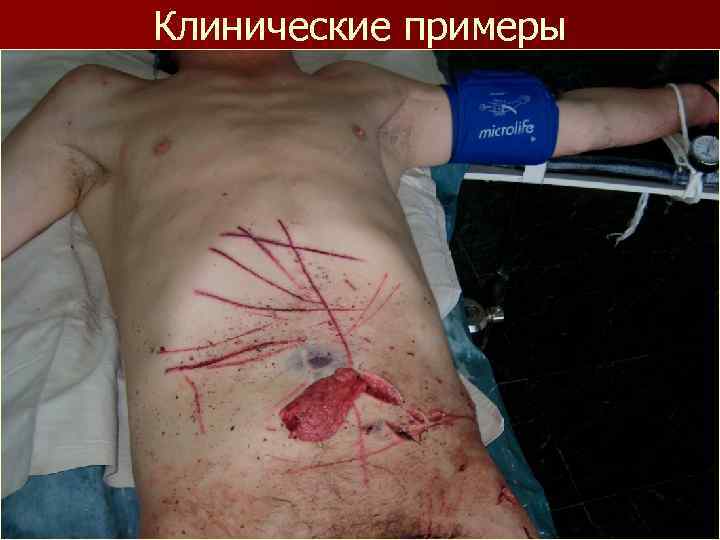 Клинические примеры 