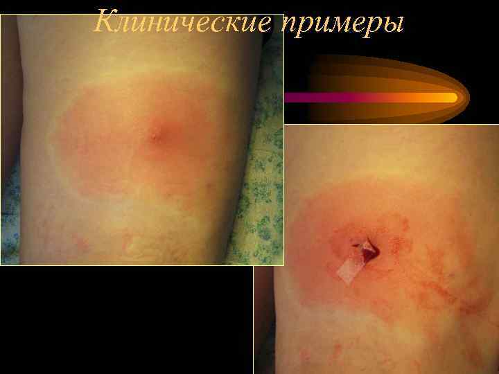 Клинические примеры 