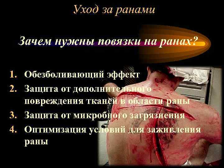 Уход за ранами Зачем нужны повязки на ранах? 1. Обезболивающий эффект 2. Защита от