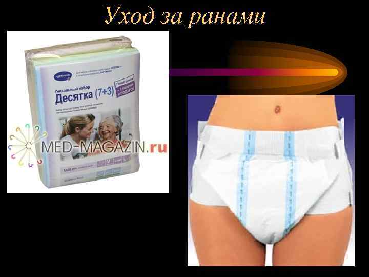 Уход за ранами 