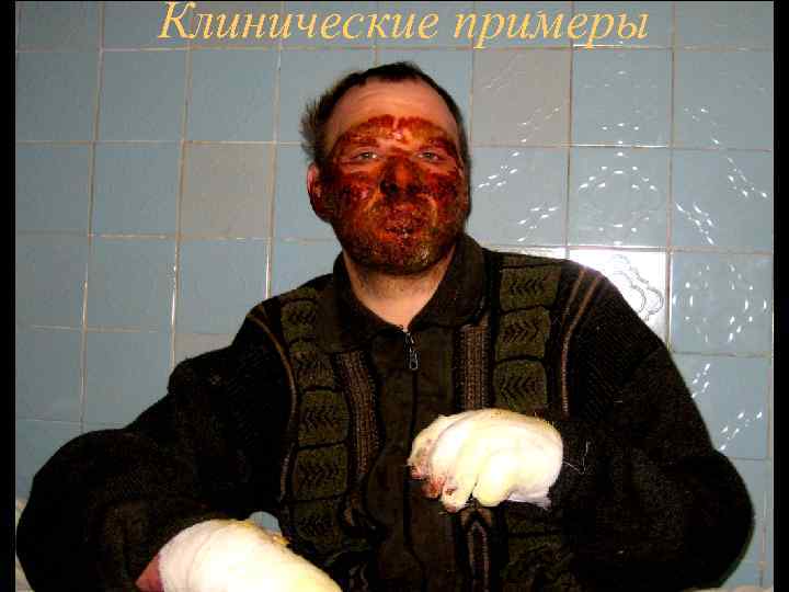 Клинические примеры 