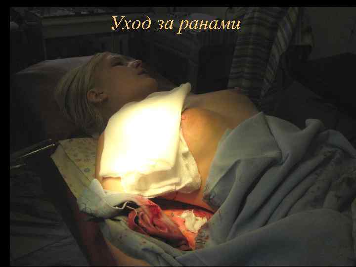 Уход за ранами 