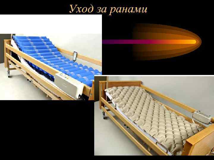 Уход за ранами 