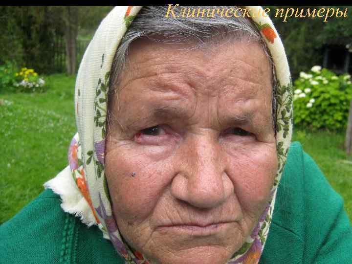Клинические примеры 