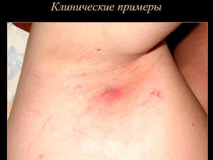 Клинические примеры 