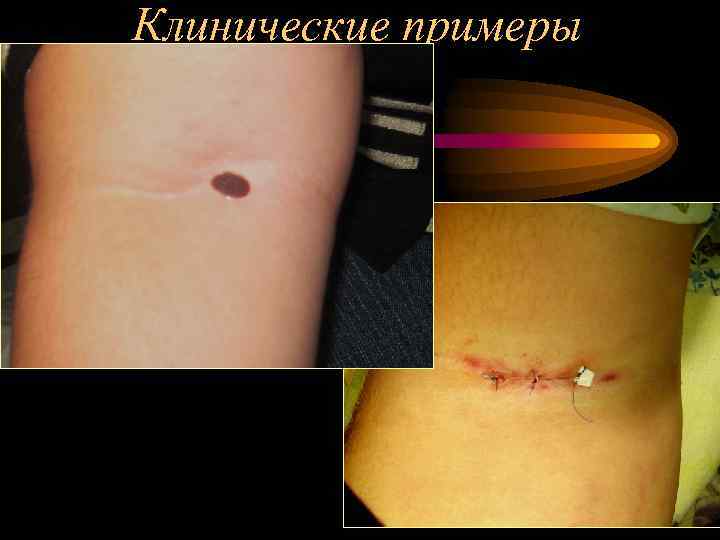 Клинические примеры 