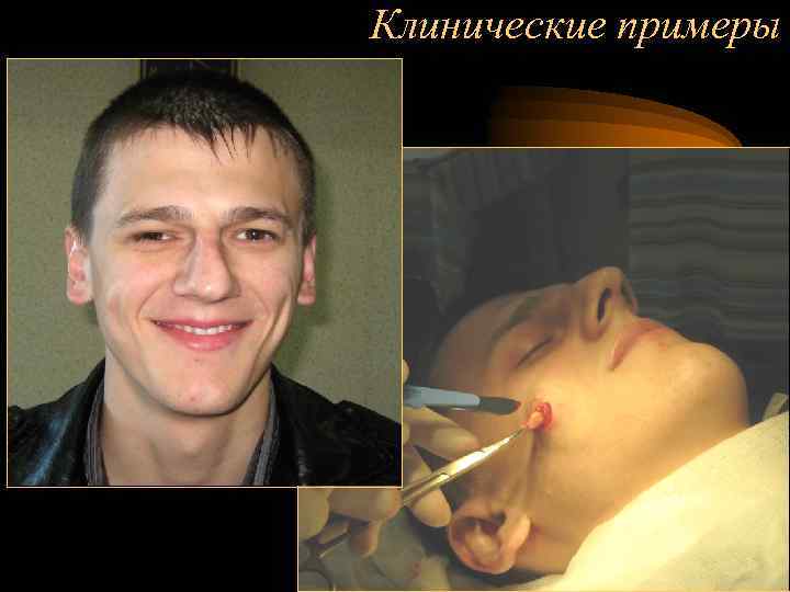 Клинические примеры 